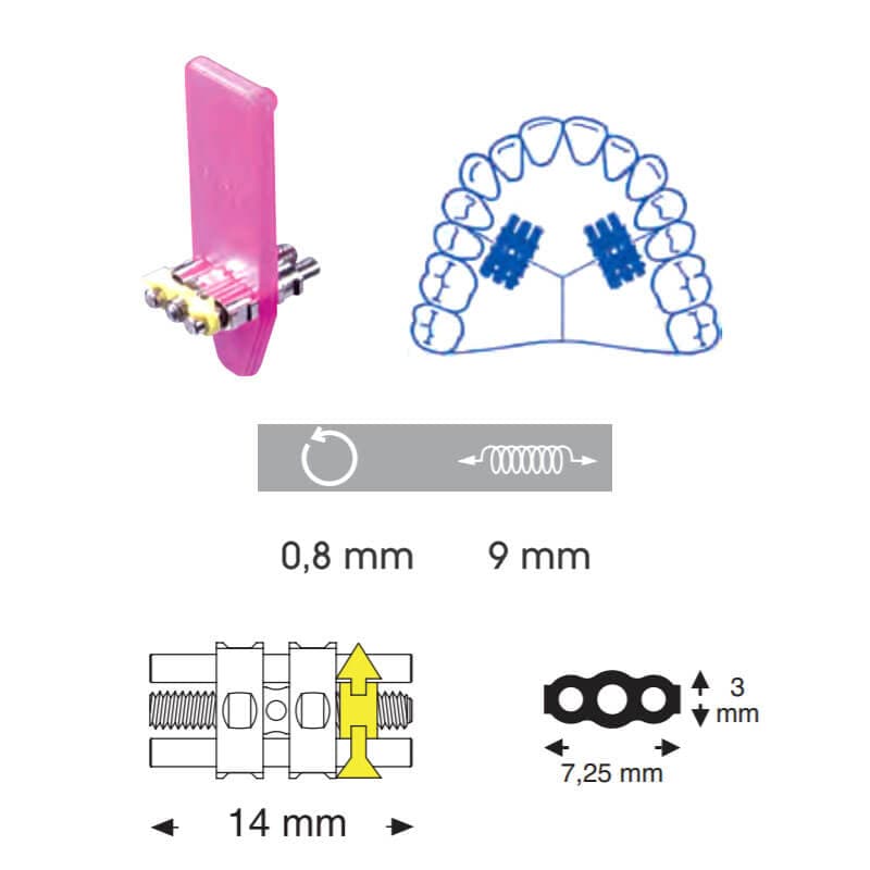 Orthodontic Medium Screw, 14 mm
