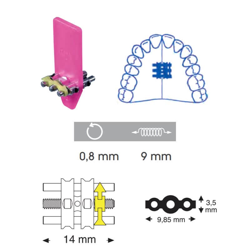Orthodontic Standard Screw, Upper, 14 mm