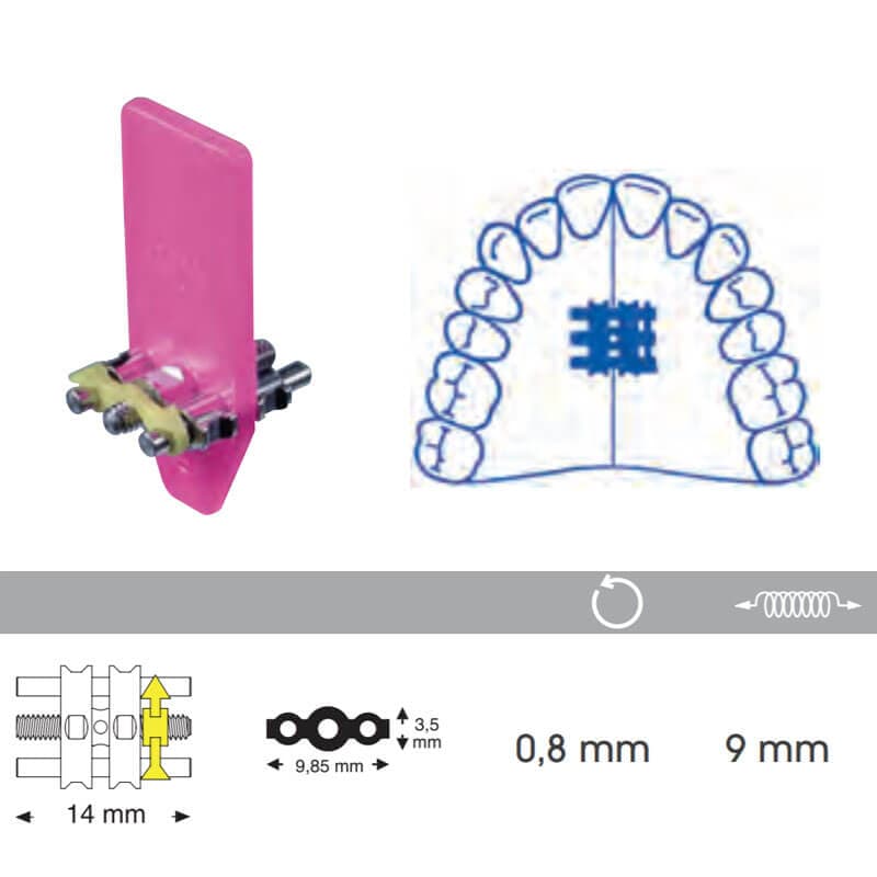 Standard Expansion Screw For Upper Jaw, 11mm