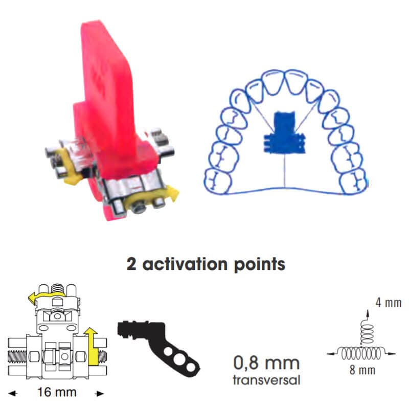 Three Directional Expansion Screw Anatomical, 16mm