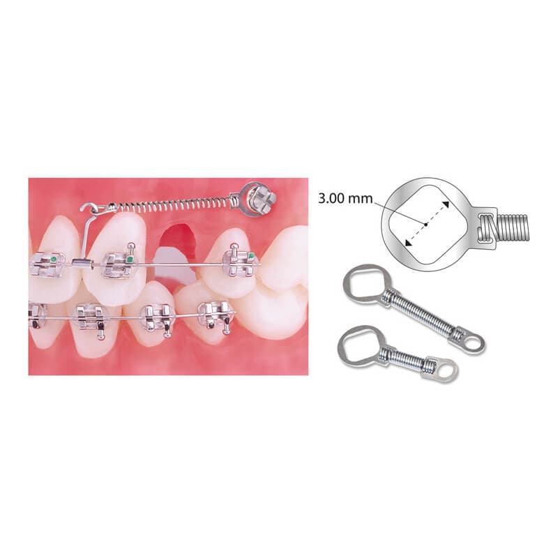 TruFlex NiTi TAD Closed Coil Spring 9mm, Heavy Force, 012x030, PK/10